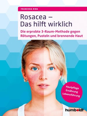 cover image of Rosacea – Das hilft wirklich